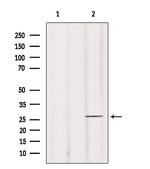 BRMS1 Antibody in Western Blot (WB)