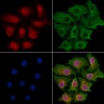 CNOT7 Antibody in Immunocytochemistry (ICC/IF)