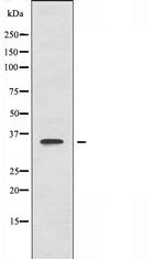 CNOT7 Antibody in Western Blot (WB)