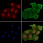 YBX2 Antibody in Immunocytochemistry (ICC/IF)