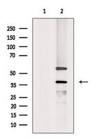 YBX2 Antibody in Western Blot (WB)