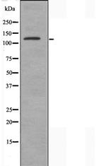 Adenylate Cyclase 5/6 Antibody in Western Blot (WB)