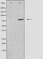 beta Adducin Antibody in Western Blot (WB)