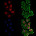 API5 Antibody in Immunocytochemistry (ICC/IF)