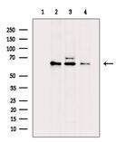 API5 Antibody in Western Blot (WB)