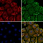 RALGAPA2 Antibody in Immunocytochemistry (ICC/IF)