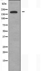 RALGAPA2 Antibody in Western Blot (WB)