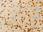 CDCA2 Antibody in Immunohistochemistry (Paraffin) (IHC (P))