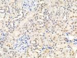 CDCA2 Antibody in Immunohistochemistry (Paraffin) (IHC (P))