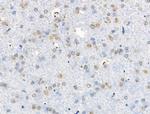 CDCA2 Antibody in Immunohistochemistry (Paraffin) (IHC (P))