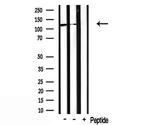 CDCA2 Antibody in Western Blot (WB)