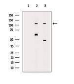 CDCA2 Antibody in Western Blot (WB)