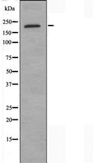 COL11A1 Antibody in Western Blot (WB)