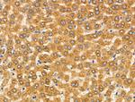 CYP2A13 Antibody in Immunohistochemistry (Paraffin) (IHC (P))