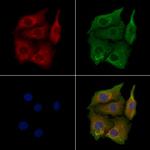 CYP2R1 Antibody in Immunocytochemistry (ICC/IF)