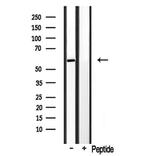 CYP3A4/CYP3A5 Antibody in Western Blot (WB)