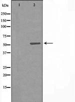 CYP7B1 Antibody in Western Blot (WB)