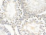 EXO1 Antibody in Immunohistochemistry (Paraffin) (IHC (P))