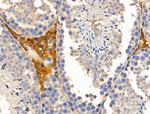 Laminin beta-1 Antibody in Immunohistochemistry (Paraffin) (IHC (P))