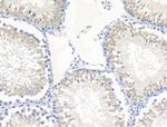 Laminin beta-1 Antibody in Immunohistochemistry (Paraffin) (IHC (P))