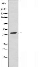 RAD51D Antibody in Western Blot (WB)