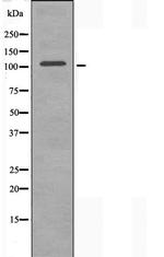 ORC1 Antibody in Western Blot (WB)