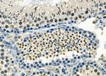 AGPAT3 Antibody in Immunohistochemistry (Paraffin) (IHC (P))