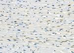 AGPAT3 Antibody in Immunohistochemistry (Paraffin) (IHC (P))