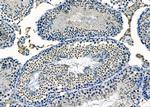 AGPAT3 Antibody in Immunohistochemistry (Paraffin) (IHC (P))