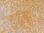 MRPL16 Antibody in Immunohistochemistry (Paraffin) (IHC (P))