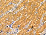 MRPL16 Antibody in Immunohistochemistry (Paraffin) (IHC (P))