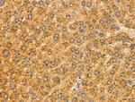 MRPL16 Antibody in Immunohistochemistry (Paraffin) (IHC (P))