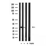 MRPL16 Antibody in Western Blot (WB)