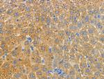 MRPL20 Antibody in Immunohistochemistry (Paraffin) (IHC (P))