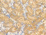 MRPL20 Antibody in Immunohistochemistry (Paraffin) (IHC (P))