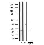 MRPL20 Antibody in Western Blot (WB)