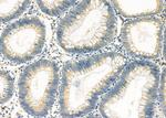 RPS4Y1 Antibody in Immunohistochemistry (Paraffin) (IHC (P))