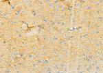 RPS4Y1 Antibody in Immunohistochemistry (Paraffin) (IHC (P))