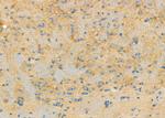 RPS4Y1 Antibody in Immunohistochemistry (Paraffin) (IHC (P))