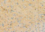 RPS4Y1 Antibody in Immunohistochemistry (Paraffin) (IHC (P))