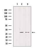 RPS4Y1 Antibody in Western Blot (WB)