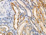 RPL10L Antibody in Immunohistochemistry (Paraffin) (IHC (P))