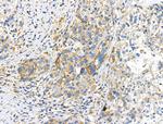 RPL10L Antibody in Immunohistochemistry (Paraffin) (IHC (P))