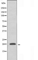 RPL10L Antibody in Western Blot (WB)