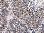 ABHDB Antibody in Immunohistochemistry (Paraffin) (IHC (P))