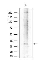 ABHDB Antibody in Western Blot (WB)