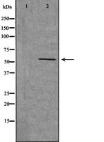 CHRNB1 Antibody in Western Blot (WB)