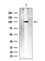 ACSS1 Antibody in Western Blot (WB)