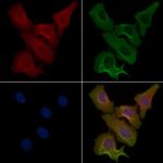 ACOT1 Antibody in Immunocytochemistry (ICC/IF)