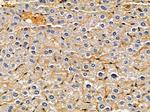 ACOT1 Antibody in Immunohistochemistry (Paraffin) (IHC (P))